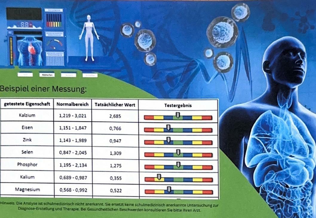 Bio Scan Vitalstoffanalyse mit Beispiel einer Messung und Auswertung